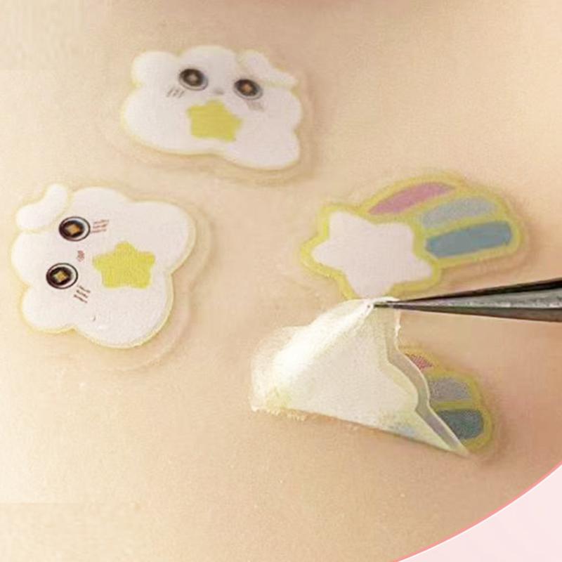 20pcs 제거 여드름 패치 스킨 케어 트리트먼트 스티 - Skincare You 리뷰 및 가격